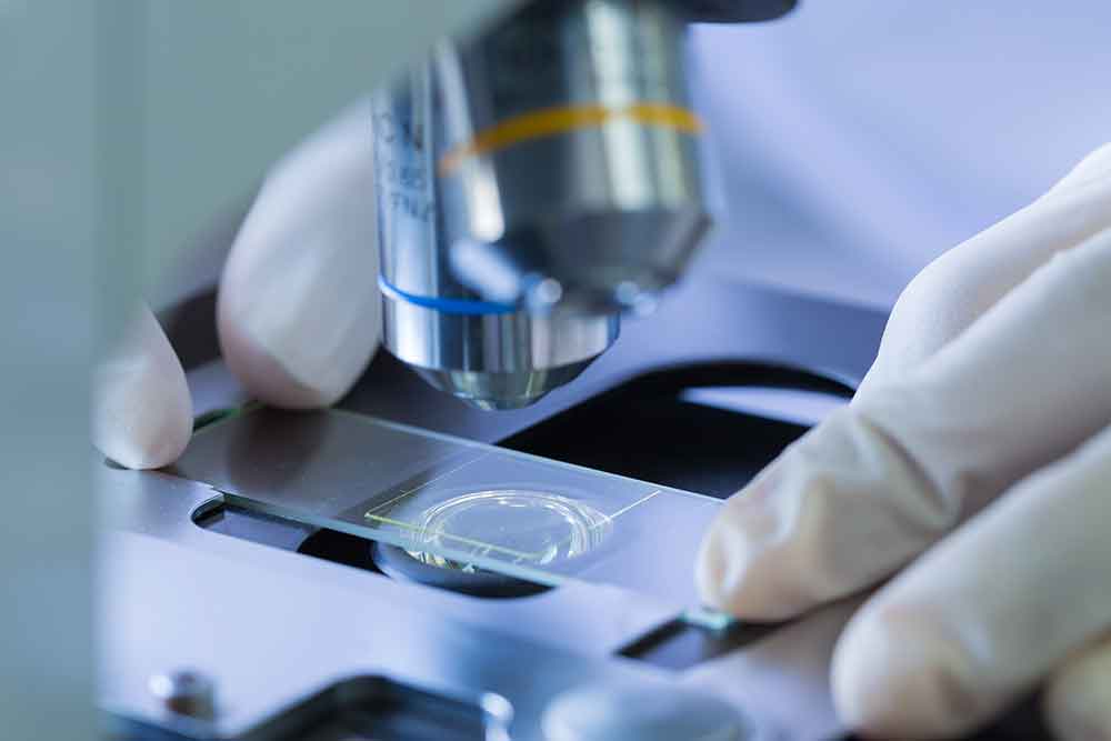 Pesquisadores italianos acham verdadeira origem do Alzheimer
